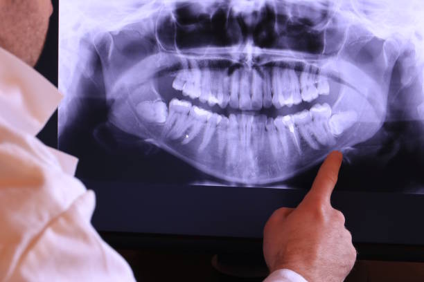 Best Cracked Tooth Emergency Dentist  in Riley, KS