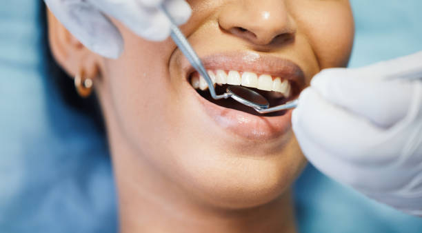Best Teeth Whitening  in Riley, KS